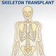 Skeleton Transplant Game